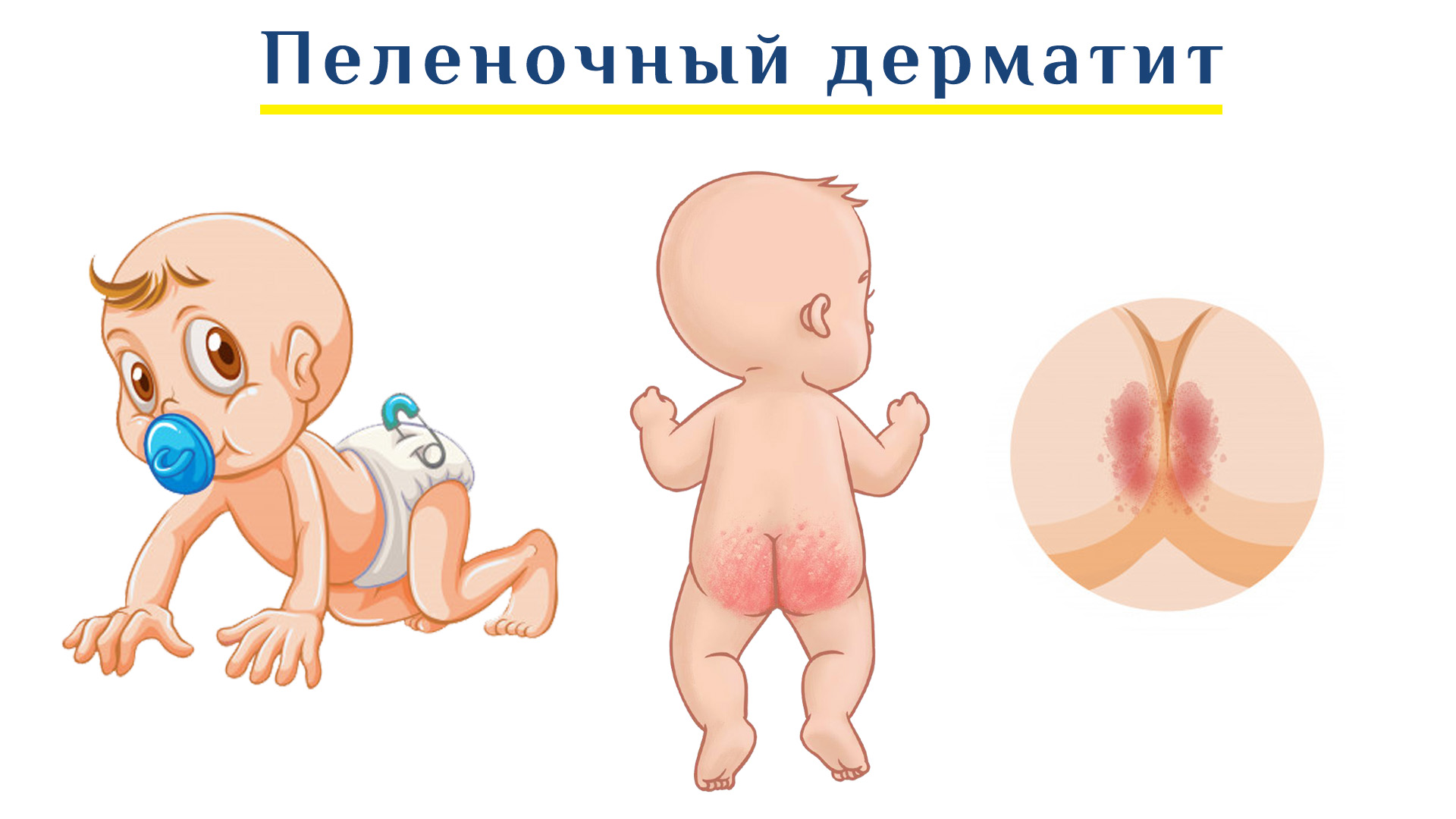 Как правильно ухаживать за новорожденным малышом